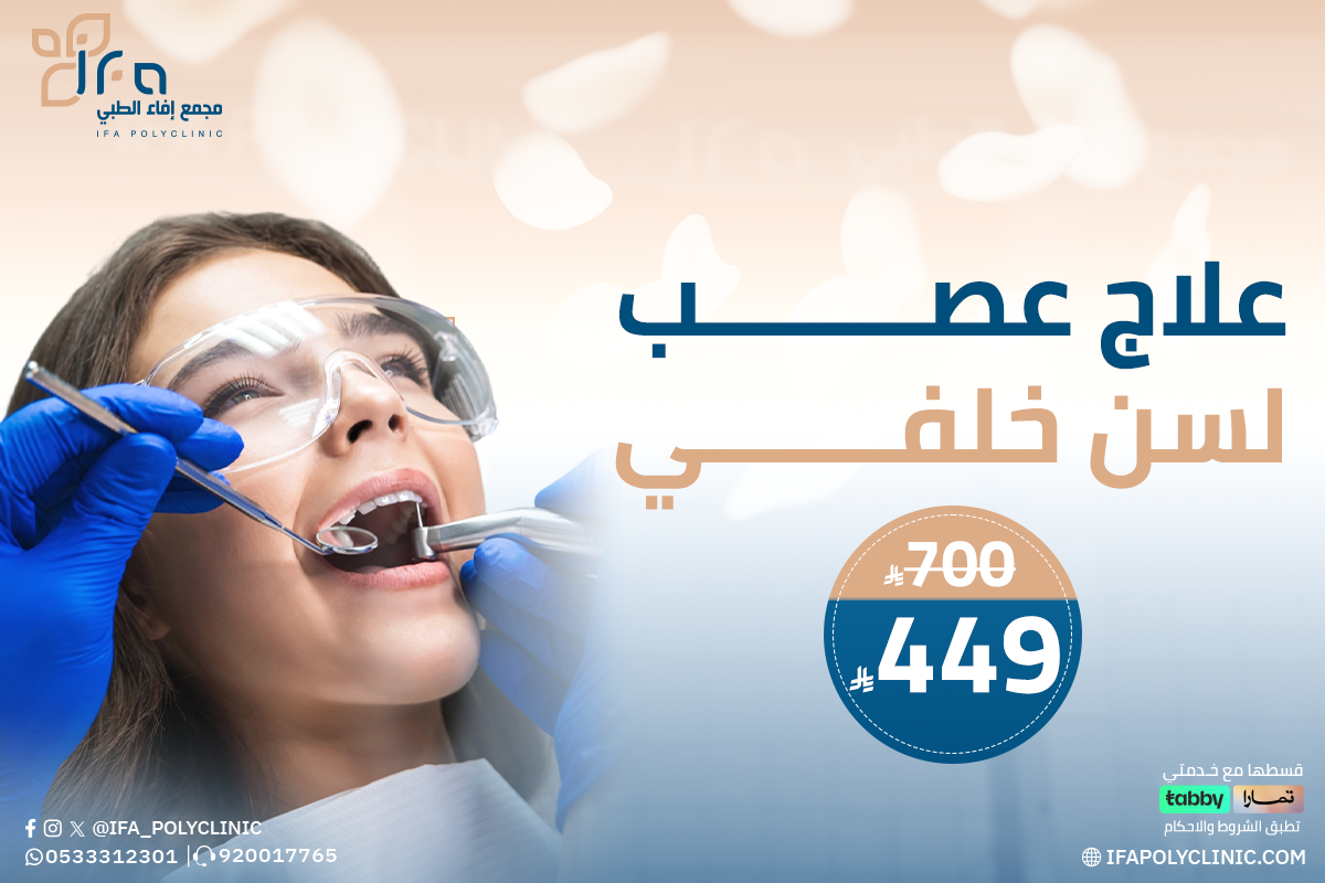 خدمة علاج عصب لسن خلفي من مجمع إيفاء الطبي